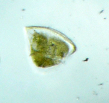 Plankton Images - Citizen Science